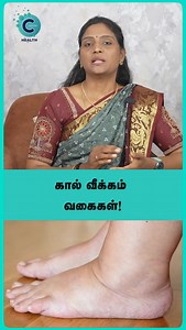 4.3K views · 77 reactions | What are the main causes of leg swelling?...