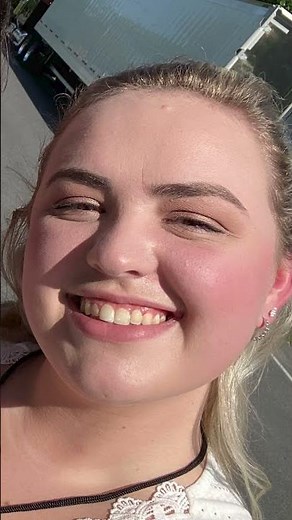 Nerve Surgery for Superior Cluneal Nerve Entrapment #nervepainrelief #lowbackpain #chronicpain