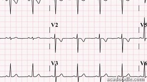 Improve your ECG skills - http://buff.ly/2p04ok0 | Acadoodle