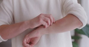 Woman Scratches Site Midge Bite On: Video có sẵn (100% miễn phí bản quyền) 3524901201 | Shutterstock