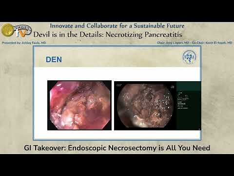 GI Takeover: Endoscopic Necrosectomy is All You Need