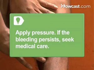 How to Treat a Dog Bite