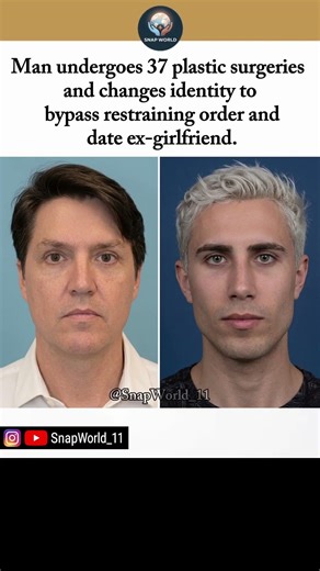 This Man Changed His Entire Face to Bypass a Restraining Order 😮 #face #change #girlfriend