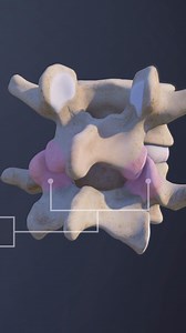 22K views · 226 reactions | Need to understand degenerative spondylolisthesis and how it causes back pain, leg pain, and nerve compression? 領 This video explains the symptoms, causes, and treatment options for spinal instability, including surgery and non-surgical care.  Perfect for anyone researching lower back pain, spinal stenosis, or slipped vertebra. ✅ | Spine-health | Facebook