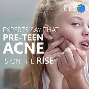 Experts say that pre-teen acne is on the rise! Join our Facebook support group for Health for All Kids to share tips & ideas: https://www.facebook.com/groups/1370129789676919/ | Health For All Kids