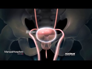 Robotic Radical Cystectomy For Male | Robotic Cystectomy | Cystectomy - Manipal Hospitals