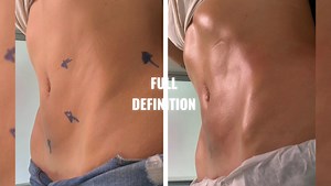 2.2K views · 29 reactions | Programa FULL DEFINITION 珞 Tus aliados en definir tu figura 殺 ✅️TENSADO LASER + MOLDEO BZ ✅️ ➡️ Reduce Grasa ➡️ Tensa la Piel ➡️ Moldeo ➡️ Definición ➡️ Resultados Rápidos ➡️ NO INVASIVO  Sabana Oeste y Goicoechea Te esperamos ! | Santa Belleza Estetic | Facebook