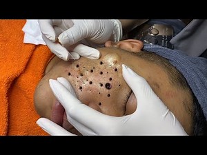 Enjoy Every Day With The Best Video Loan Nguyen Spa Official | 903