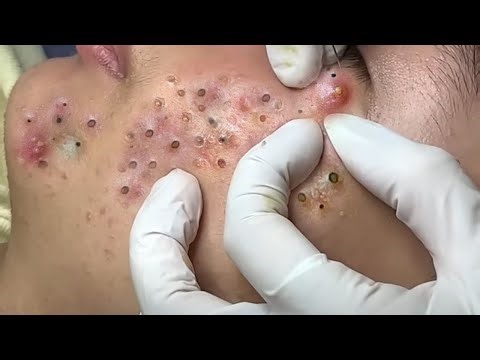 𝑺𝒐𝒐𝒕𝒉𝒊𝒏𝒈 𝑭𝒂𝒄𝒊𝒂𝒍 𝑻𝒓𝒆𝒂𝒕𝒎𝒆𝒏𝒕 𝒇𝒐𝒓 𝑺𝒕𝒓𝒆𝒔𝒔 𝑹𝒆𝒍𝒊𝒆𝒇 | 𝑫𝒆𝒆𝒑 𝑪𝒍𝒆𝒂𝒏𝒊𝒏𝒈 & 𝑪𝒂𝒍𝒎𝒊𝒏𝒈 𝑴𝒂𝒔𝒔𝒂𝒈𝒆 𝒂𝒕 𝑳𝒖𝒙𝒖𝒓𝒚 𝑺𝒑𝒂 #𝟗𝟎𝟎𝟐𝟒