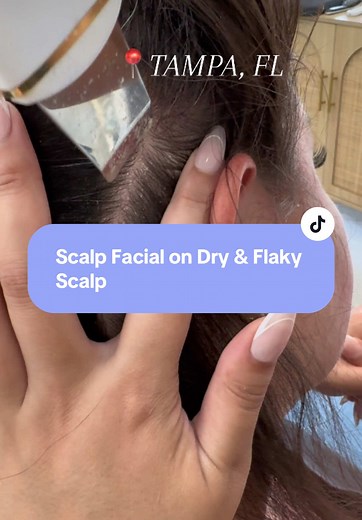 Scalp Facial Treatment for Dry and Flaky Scalp