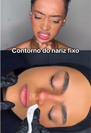 Contorno de Nariz Fixo: O Que Estão Inventando?