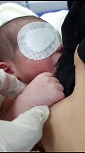 Perfect lactation for a newborn baby with neonatal hypoglycemia, أرضاع ناجح لطفل وليد يعاني هبوط سكر ولادي . | الرضاعة الطبيعية وتغذية الطفل