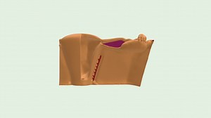 Broad Ligament of the Uterus - 3D model by jplister