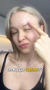 Откуда шрам у меня на лбу? 💔💔