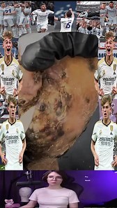 Reach to rescue little Toenails from mango worms removal 😭😭💔💔 #fypシ゚ #rescue #rescuedog #rescue #botfly #mangoworm #dog #doglove | Dr. Vinord Gambia