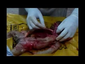 Autopsy of an Infant with Placenta attached and Viscera sent for Histopathology