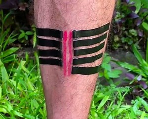 Clever First Aid Camping Tips! | 5-Minute Crafts