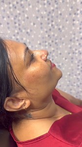 28K views · 56 reactions | A conversation with one of beautifuk clients who came in for botox ✨ #botox #crowsfeet #wrinkles #filler #antiaging #dermalfiller #chinfiller #lipfiller #srilanka #colombo | Dr. Sarah Fazy / Dr. Cherry | Facebook