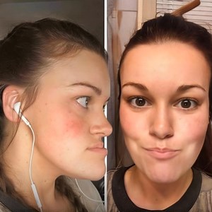 48K views · 70 reactions | This woman once "hated looking in the mirror" but after undergoing double jaw surgery, everything changed!  Her incredible transformation is nothing short of inspiring. Curious to see how she looks now? Tap the link in the top comment to check out the before-and-after photos and discover how this brave decision helped her gain confidence and embrace her true beauty! ⬇️⬇️⬇️ | About Everything | Facebook