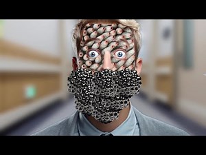 ASMR Remove Big Acne & Worm Infected Face Treatment || Deep Cleaning Animation @PaponASMR |/