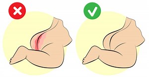 12 Effective Ways To Treat Diaper Rashes In Babies