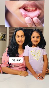 172K views · 3.5K reactions | Injuries and skin conditions explained in English #SkinConditions #InjuryAwareness #DermatologyFacts #HealthEducation #SkinCareTips | DivyAshwanth Reddy | Facebook