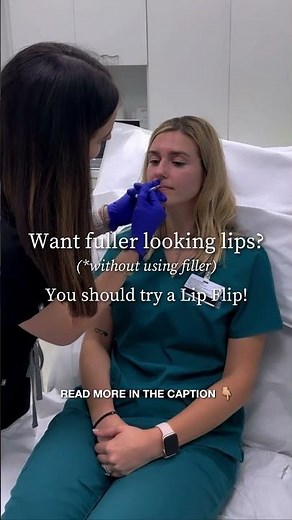 How to Get Naturally Fuller Lips (No Filler Needed!)