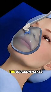 1.8K views | See how doctors fix thumb pain with Basal Joint Surgery! #basaljointsurgery #thumbpain #HandSurgery #medicalanimation #DoctorExplains | Dr. Elon Swift | Facebook