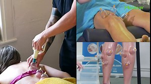 Moclever 32 Cups Cupping Set with Pump, Chinese Massage Therapy Cupping Set Body Vacuum Suction Kit Acupoint Massage Kit