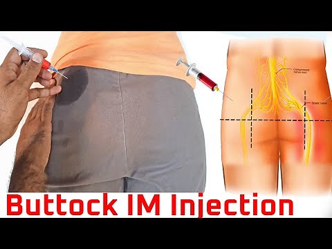 How to give an intermuscular (IM) injection in gluteal muscle at home buttock injection technique
