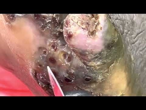 Dan Outa’s left foot jigger digging - see full video @riseupsociety.net