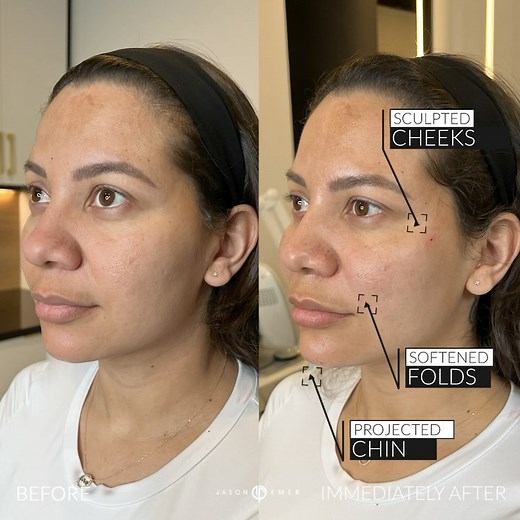 1.5K views · 17 comments | DYNAMIC DUO: FILLER AND THREADS Our...