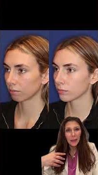 Facial Balancing in NYC with Dr. Jennifer Levine
