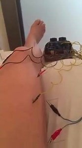 So this time we've attached electric stim to each acupuncture needle. Trying to get this darn IT Band to relax. For the record, this does not tickle. | Paige Davis