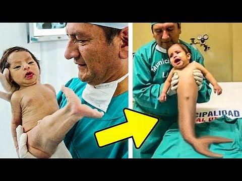 What Happened to the Baby Mermaid? See What Happened in the Surprising Case