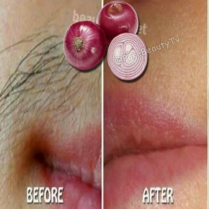 228K views · 2.6K reactions | Stop! Shaving it is the easiest way to remove facial body and pubic hair without pain | Pure Beauty Tv | Facebook
