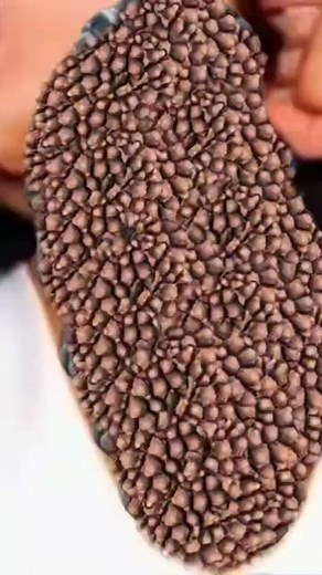 Neck Treatment 💯 Real Result #asmr #videos #asmranimation #viralvideoシfyp #relaxingsound | Viral Cyb