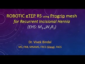Robotic eTEP RS (AWR) using Progrip mesh for recurrent incisional M3-4 W2 R1 hernia