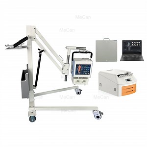 [Hot Item] X-ray Equipment Digital Human X Ray Machine Portable 300mA Chest Xray for Human