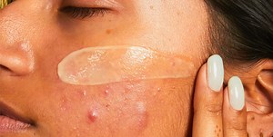 Guide to chemical exfoliants: What are they, how to use them and how much is too much? | BURO.