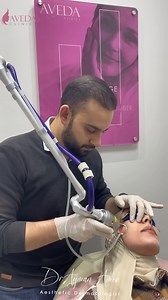 Fractional laser session to treat wound scars By our Dr. Ayman Amer From qualified medical team 🙏😍 Your are the most beautiful Aveda Clinics 😍 #aveda #aveda_medical_team | Aveda Clinics
