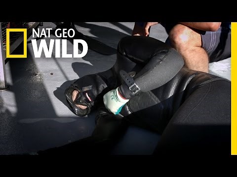 The World's Most Painful Jellyfish Sting | Secret Life of Pearls