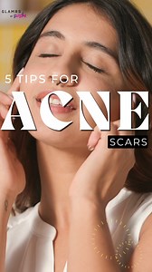 1.1K views · 27 reactions | Learn effective ways to combat acne scars and achieve smooth, blemish-free skin. | Glamrs | Facebook