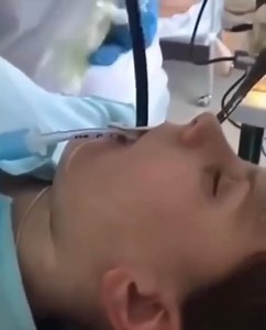 Des médécins retirent un ver solitaire par la bouche du patient