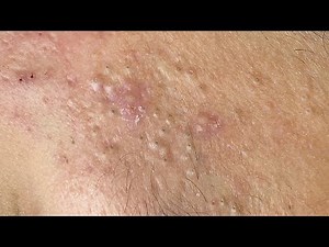 Satisfying Relaxing with Sac Dep Spa #339