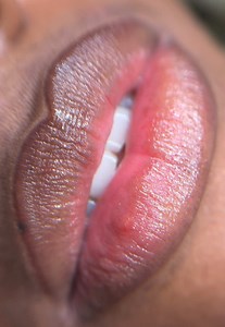 Ombre lips (lip blush) : technique d'ombrage permanent des lèvres