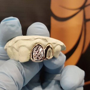 ⏹ Diamond Cut Window ⏹ Followed by Plain Gold "Open Face" Incisor. #GoldInAction #LifeStylezGrillz Contact us - 1-242-535-8303 #gold #yellowgold #whitegold #10k #custom #quality #grillz #goldteeth #golden #diamondcut #teeth #jeweller #jewelry #bling #bahamas #nassau #downtown #plaingold #examination | LifeStylez Jewelry