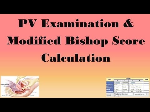 PV Examination & Modified Bishop Score Calculation