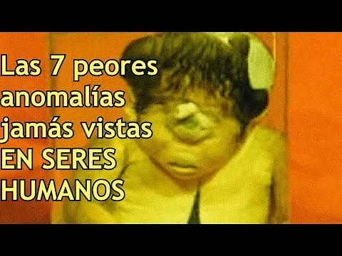 Las 7 peores anomalías jamás vistas en seres humanos
