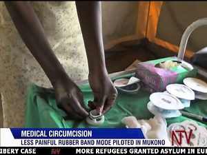 Circumcision by Prepex method